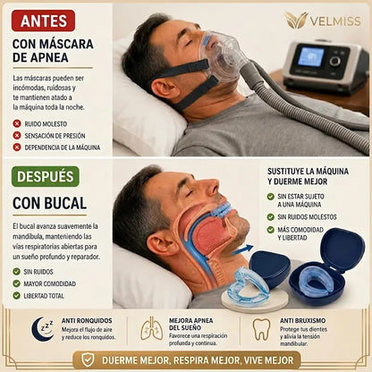 Férula bucal antirronquidos